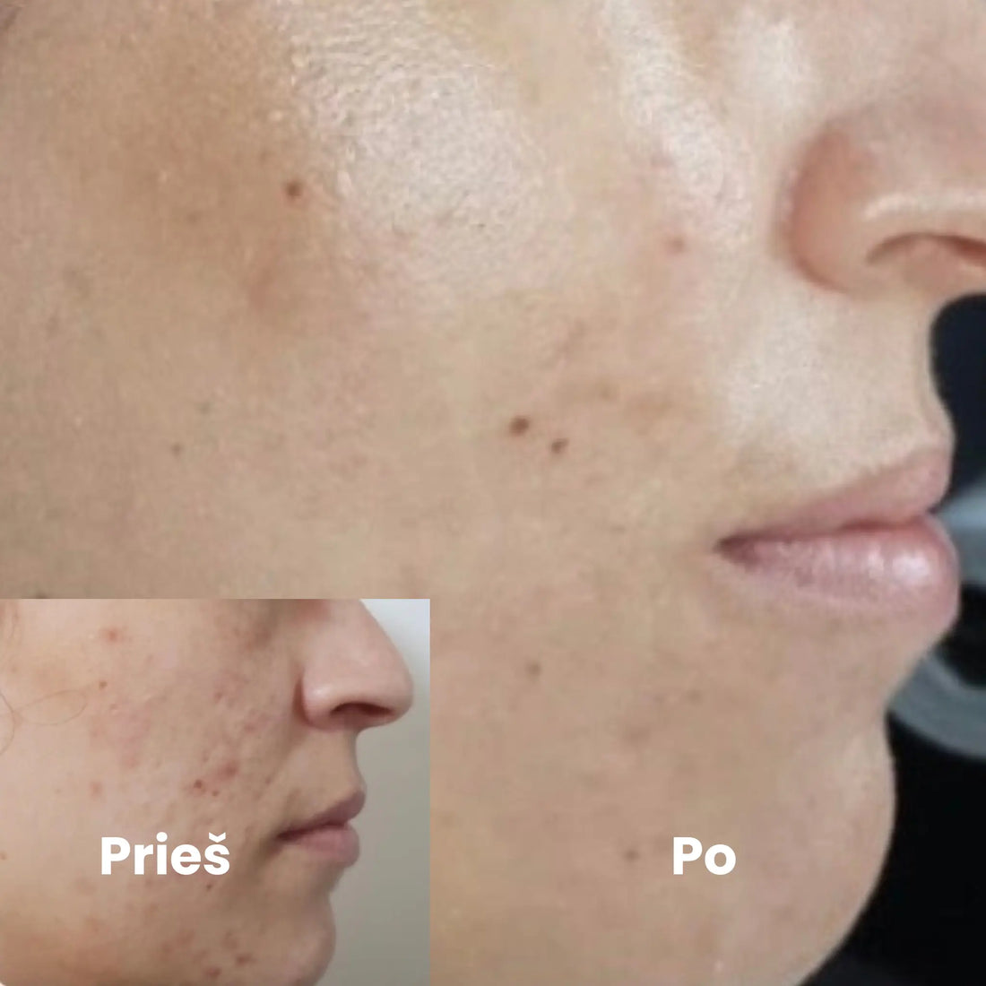 Kosmetologo konsultacija kabinete ir odos priežiūros planas (45 min)