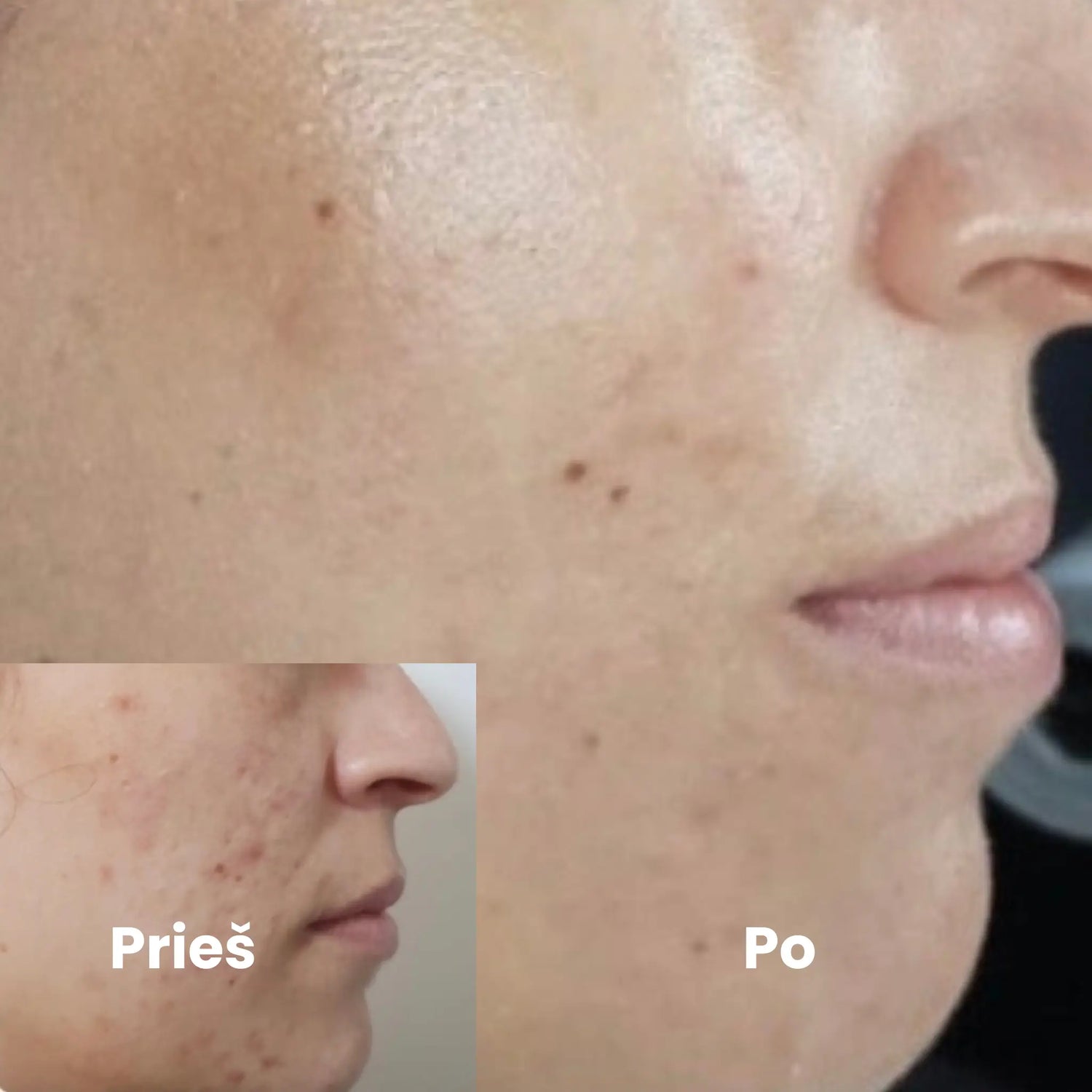 Kosmetologo konsultacija kabinete ir odos priežiūros planas (45 min)